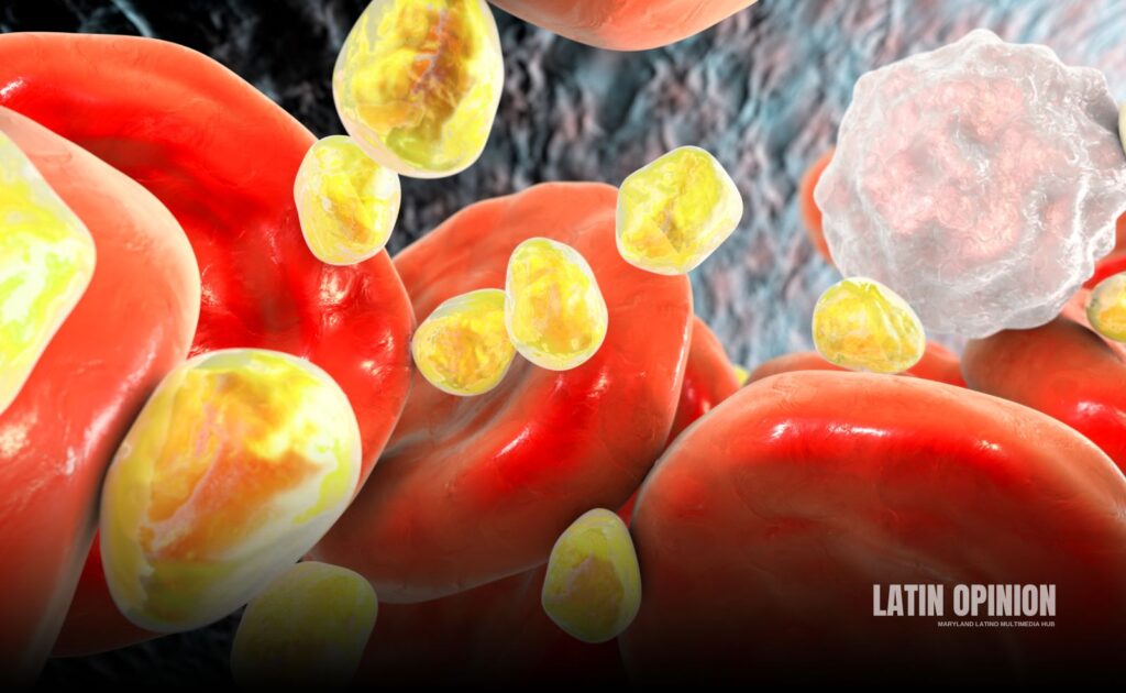 Síndrome de DiGeorge