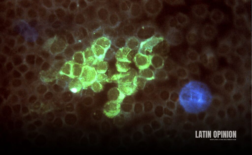 Nuevo antiviral contra herpes simple